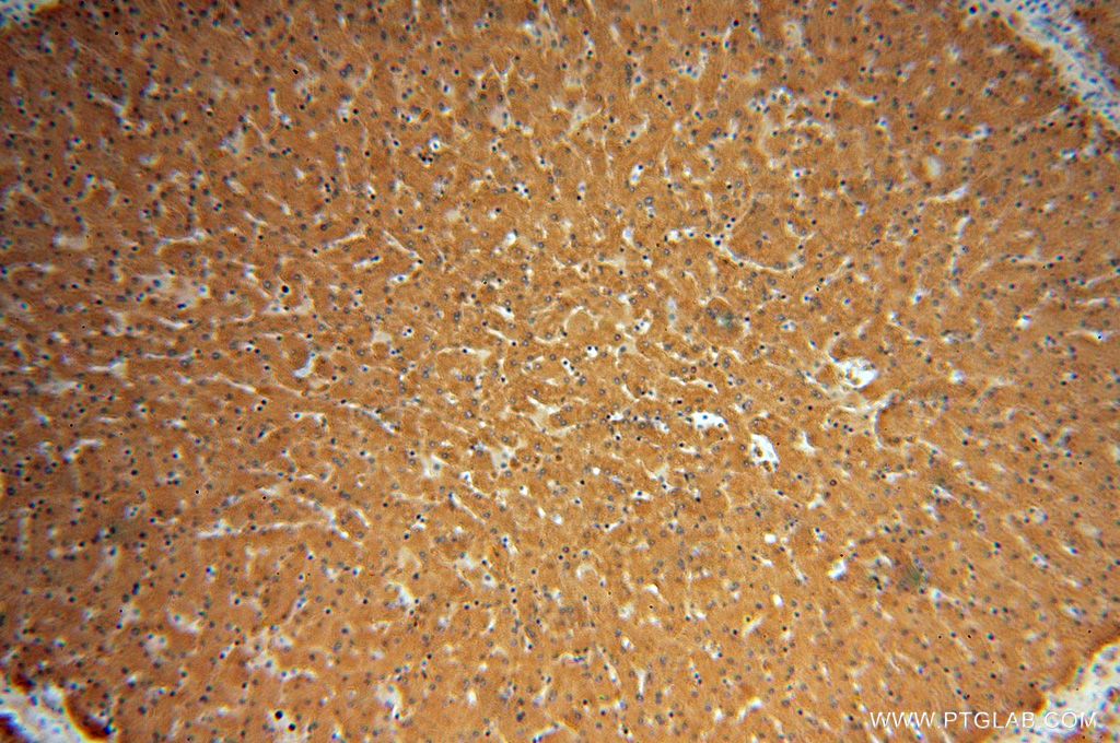 Immunohistochemistry (IHC) staining of human liver tissue using DPYS Polyclonal antibody (13237-1-AP)