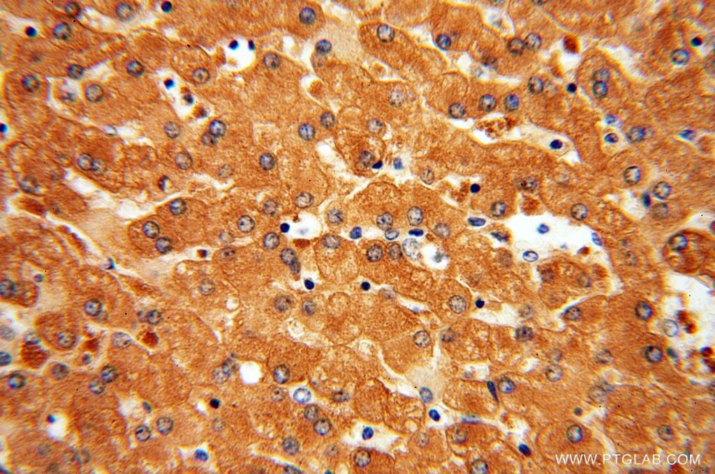 Immunohistochemistry (IHC) staining of human liver tissue using DPYS Polyclonal antibody (13237-1-AP)