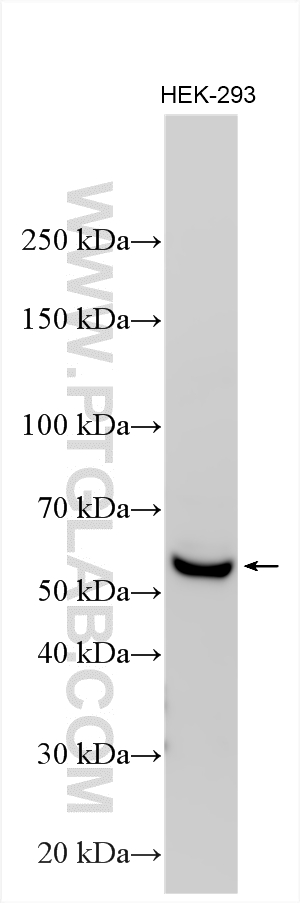 Western Blot (WB) analysis of various lysates using DPYS Polyclonal antibody (13237-1-AP)