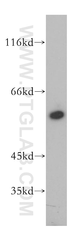 Western Blot (WB) analysis of HEK-293 cells using DPYS Polyclonal antibody (13237-1-AP)