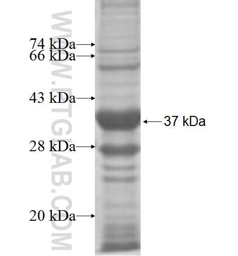 DPYS fusion protein Ag6925 SDS-PAGE