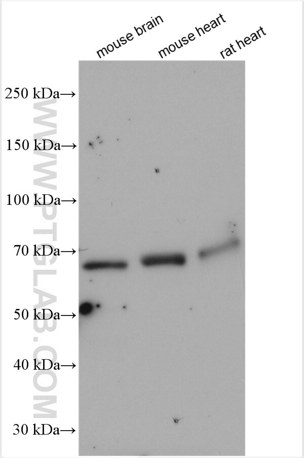 Western Blot (WB) analysis of various lysates using CRMP2 Polyclonal antibody (14521-1-AP)