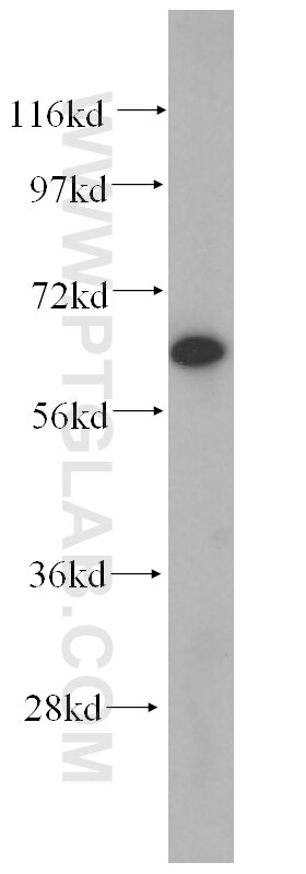 Western Blot (WB) analysis of human heart tissue using CRMP2 Polyclonal antibody (14521-1-AP)