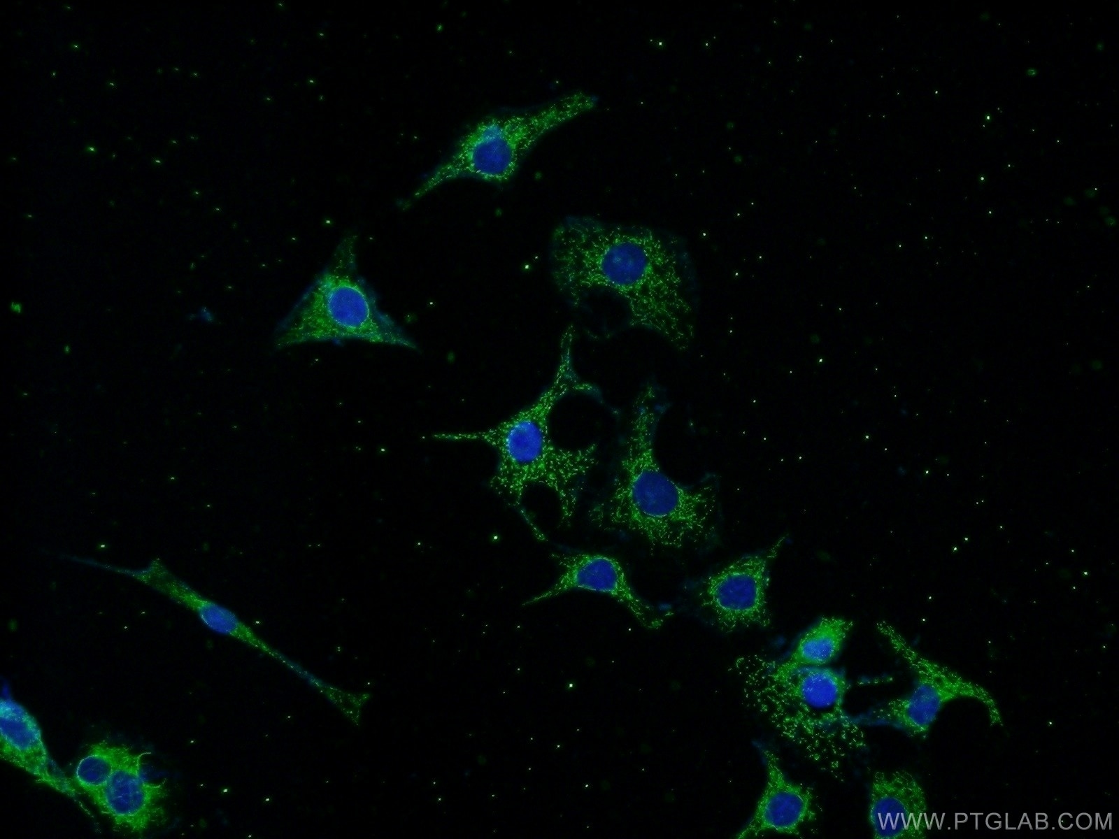 Immunofluorescence (IF) / fluorescent staining of SH-SY5Y cells using CRMP2 Polyclonal antibody (14686-1-AP)