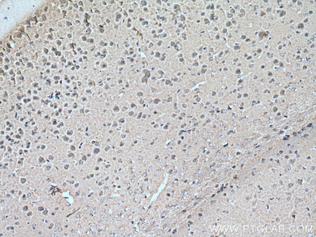 Immunohistochemistry (IHC) staining of mouse brain tissue using CRMP2 Polyclonal antibody (14686-1-AP)