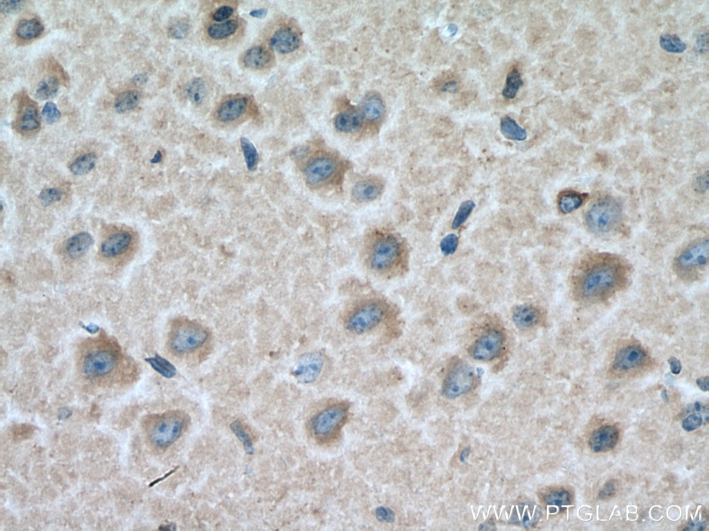 Immunohistochemistry (IHC) staining of mouse brain tissue using CRMP2 Polyclonal antibody (14686-1-AP)
