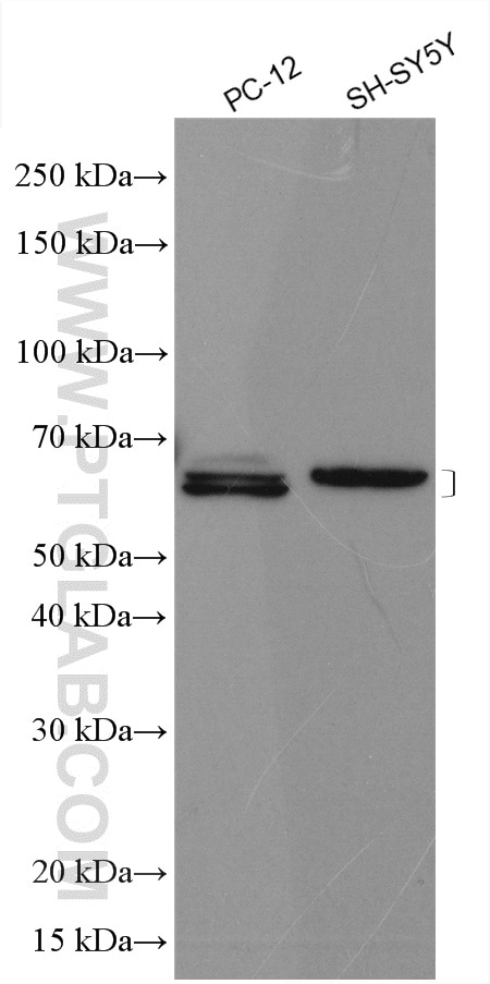 Western Blot (WB) analysis of various lysates using CRMP2 Polyclonal antibody (14686-1-AP)