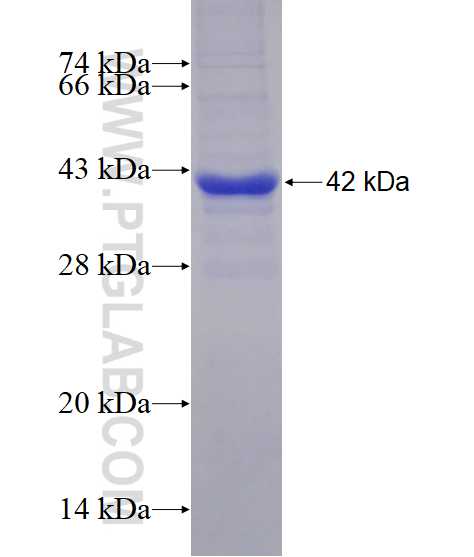 DPYSL2 fusion protein Ag5987 SDS-PAGE