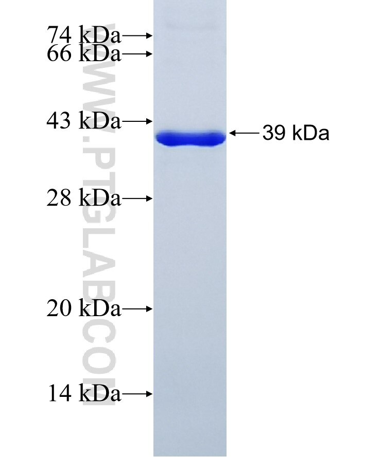 DPYSL2 fusion protein Ag5987 SDS-PAGE