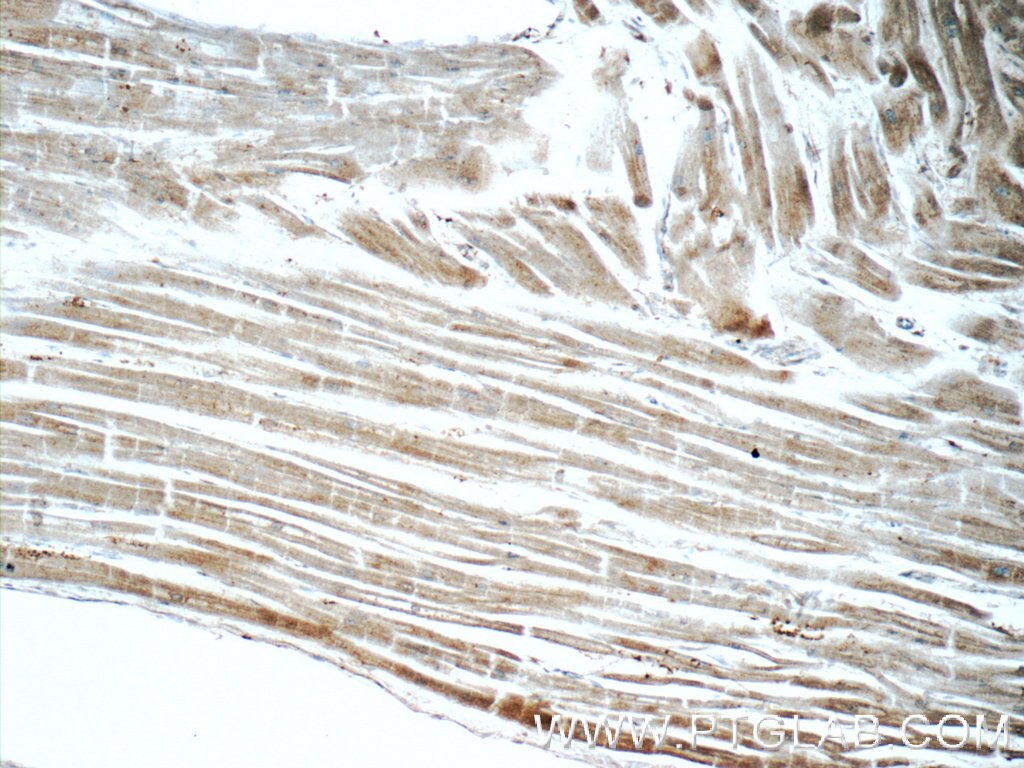 Immunohistochemistry (IHC) staining of human heart tissue using CRMP4 Polyclonal antibody (13661-1-AP)