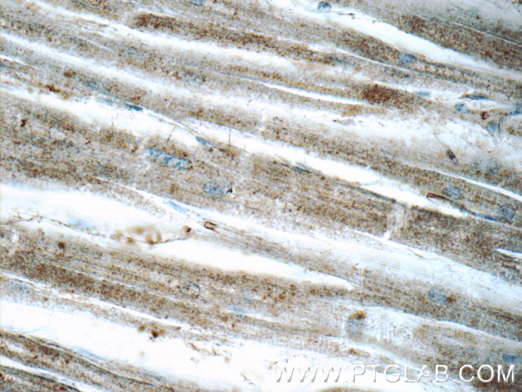 Immunohistochemistry (IHC) staining of human heart tissue using CRMP4 Polyclonal antibody (13661-1-AP)