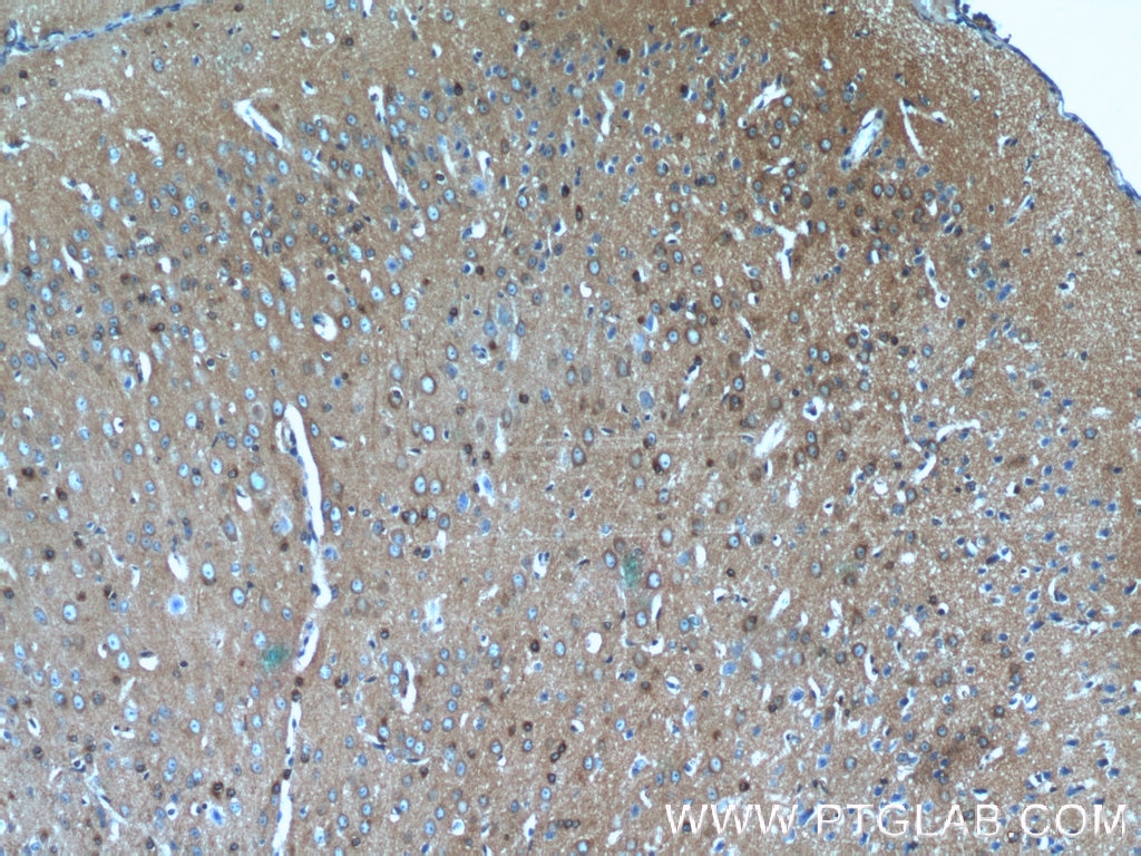 IHC staining of mouse brain using 13661-1-AP