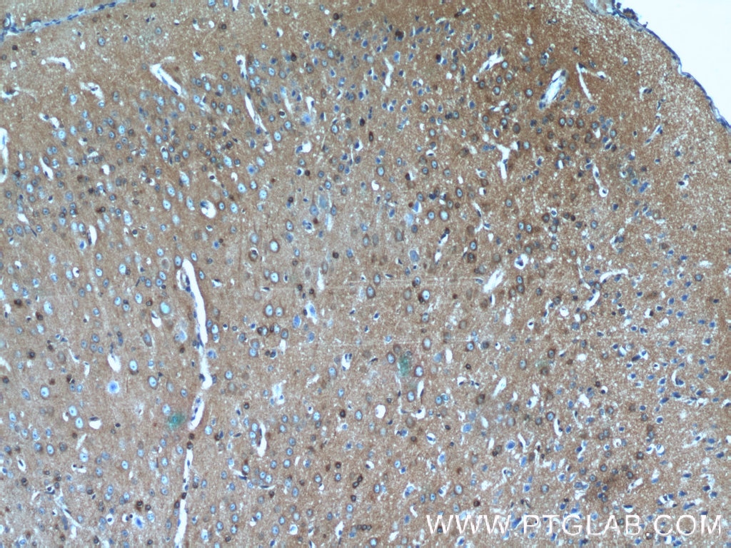 Immunohistochemistry (IHC) staining of mouse brain tissue using CRMP4 Polyclonal antibody (13661-1-AP)