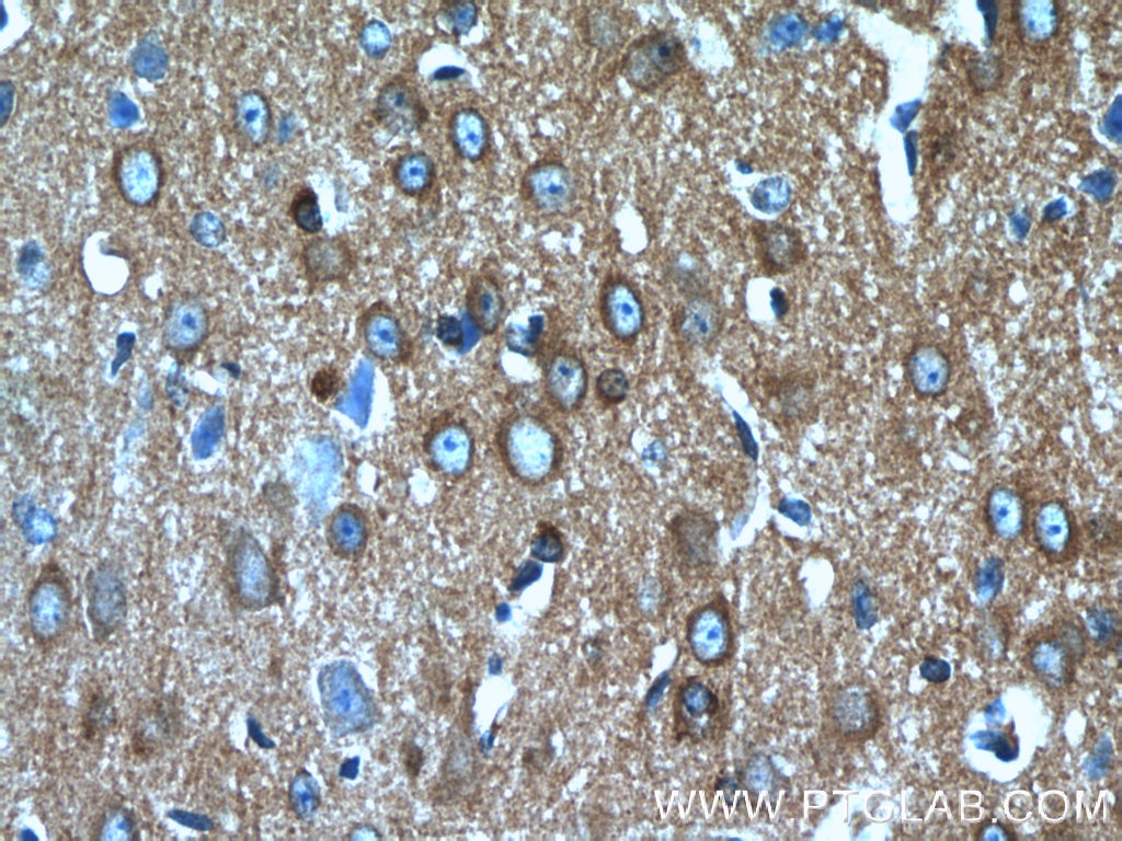 Immunohistochemistry (IHC) staining of mouse brain tissue using CRMP4 Polyclonal antibody (13661-1-AP)