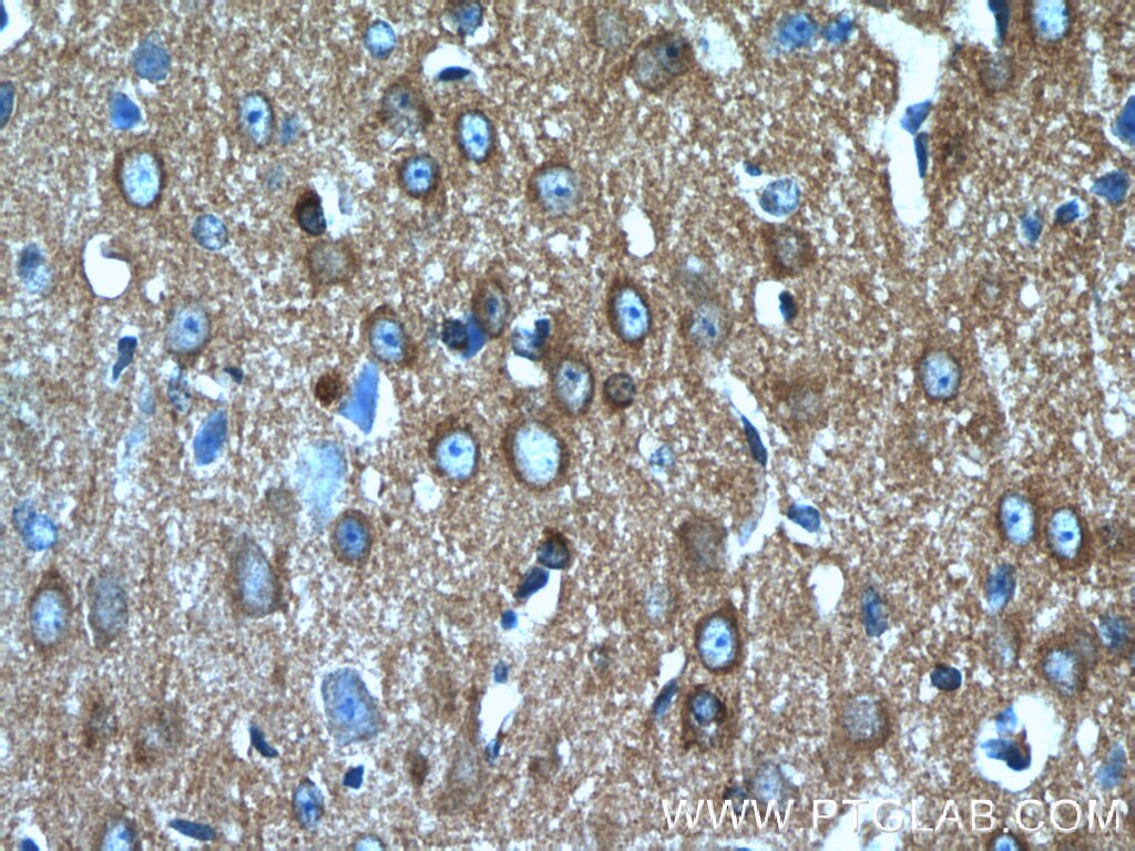 IHC staining of mouse brain using 13661-1-AP