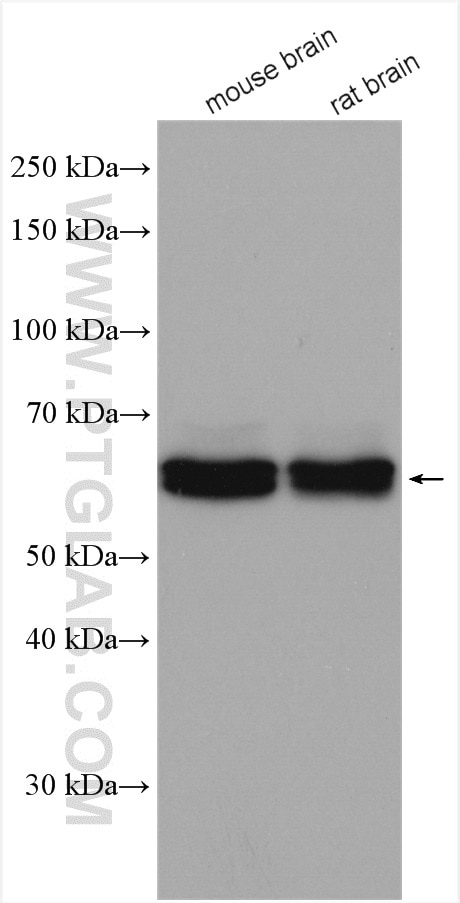 Western Blot (WB) analysis of various lysates using CRMP4 Polyclonal antibody (13661-1-AP)