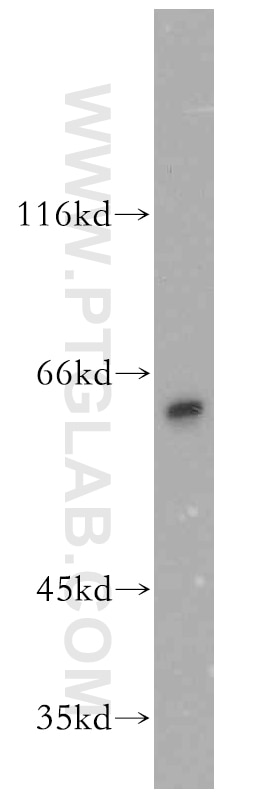 Western Blot (WB) analysis of mouse cerebellum tissue using CRMP4 Polyclonal antibody (13661-1-AP)