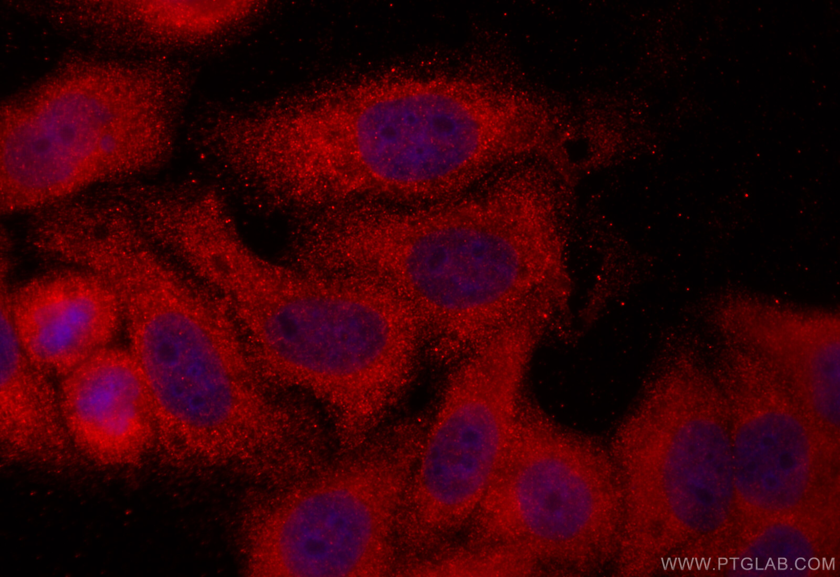 Immunofluorescence (IF) / fluorescent staining of HepG2 cells using CRMP4 Polyclonal antibody (18969-1-AP)