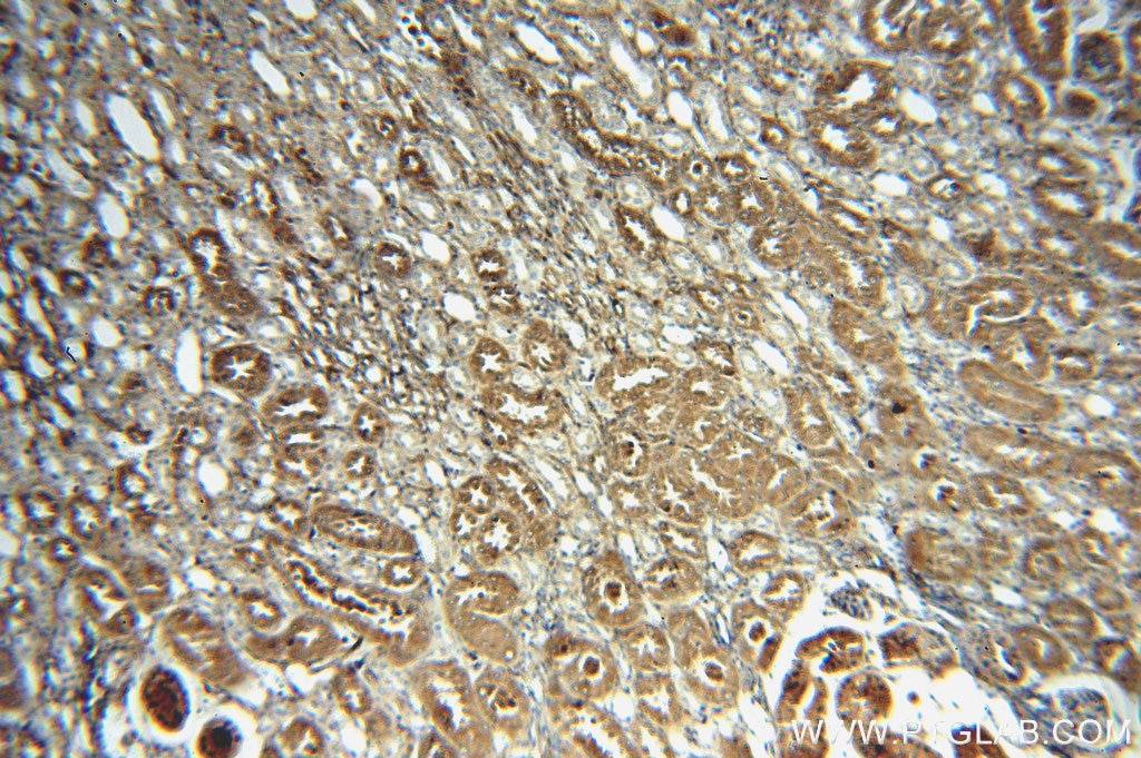 Immunohistochemistry (IHC) staining of human kidney tissue using CRMP4 Polyclonal antibody (18969-1-AP)