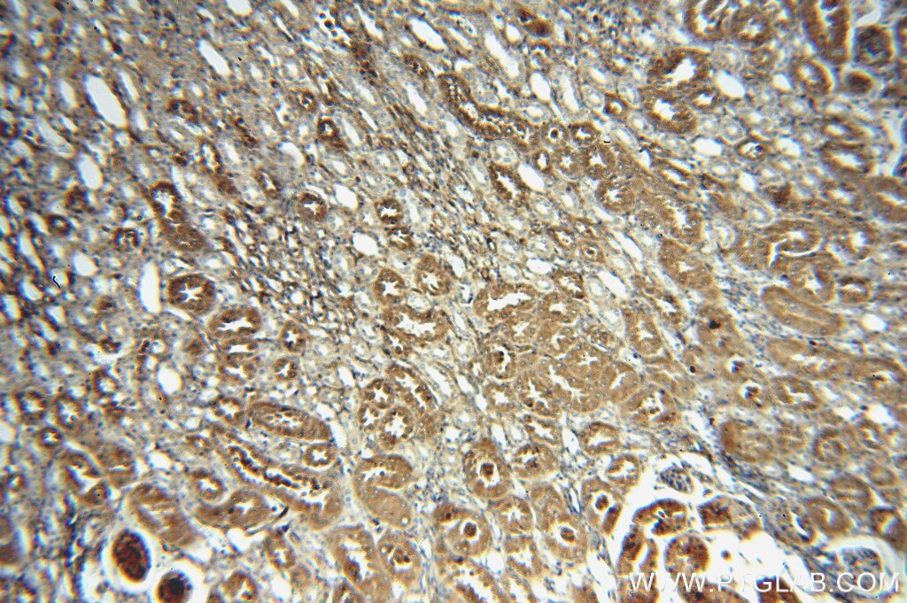 IHC staining of human kidney using 18969-1-AP