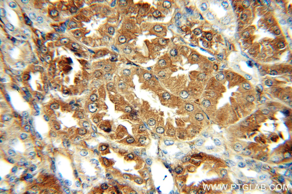 Immunohistochemistry (IHC) staining of human kidney tissue using CRMP4 Polyclonal antibody (18969-1-AP)