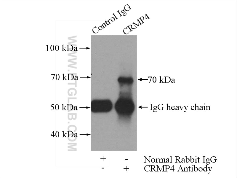 Immunoprecipitation (IP) experiment of SH-SY5Y cells using CRMP4 Polyclonal antibody (18969-1-AP)