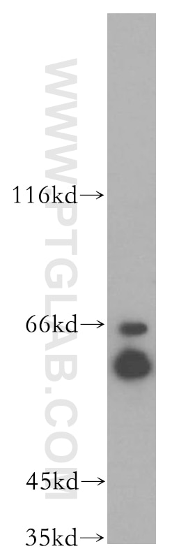 Western Blot (WB) analysis of Jurkat cells using CRMP4 Polyclonal antibody (18969-1-AP)