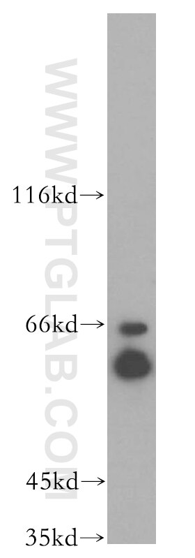 WB analysis of Jurkat using 18969-1-AP