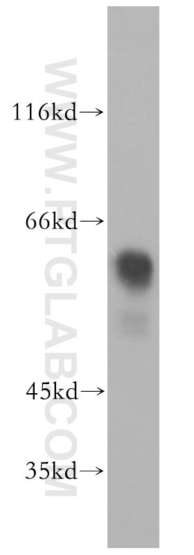 WB analysis of SH-SY5Y using 18969-1-AP