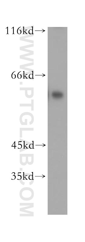 Western Blot (WB) analysis of SH-SY5Y cells using CRMP4 Polyclonal antibody (18969-1-AP)