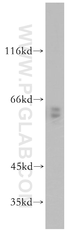 Western Blot (WB) analysis of mouse thymus tissue using CRMP4 Polyclonal antibody (18969-1-AP)