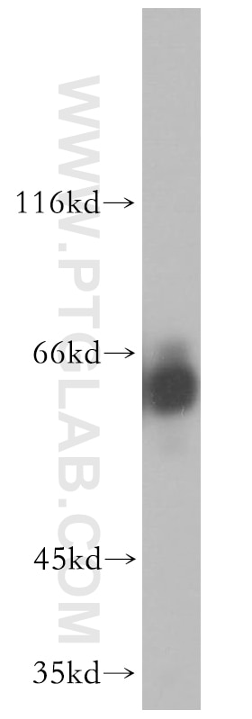 Western Blot (WB) analysis of mouse cerebellum tissue using CRMP4 Polyclonal antibody (18969-1-AP)