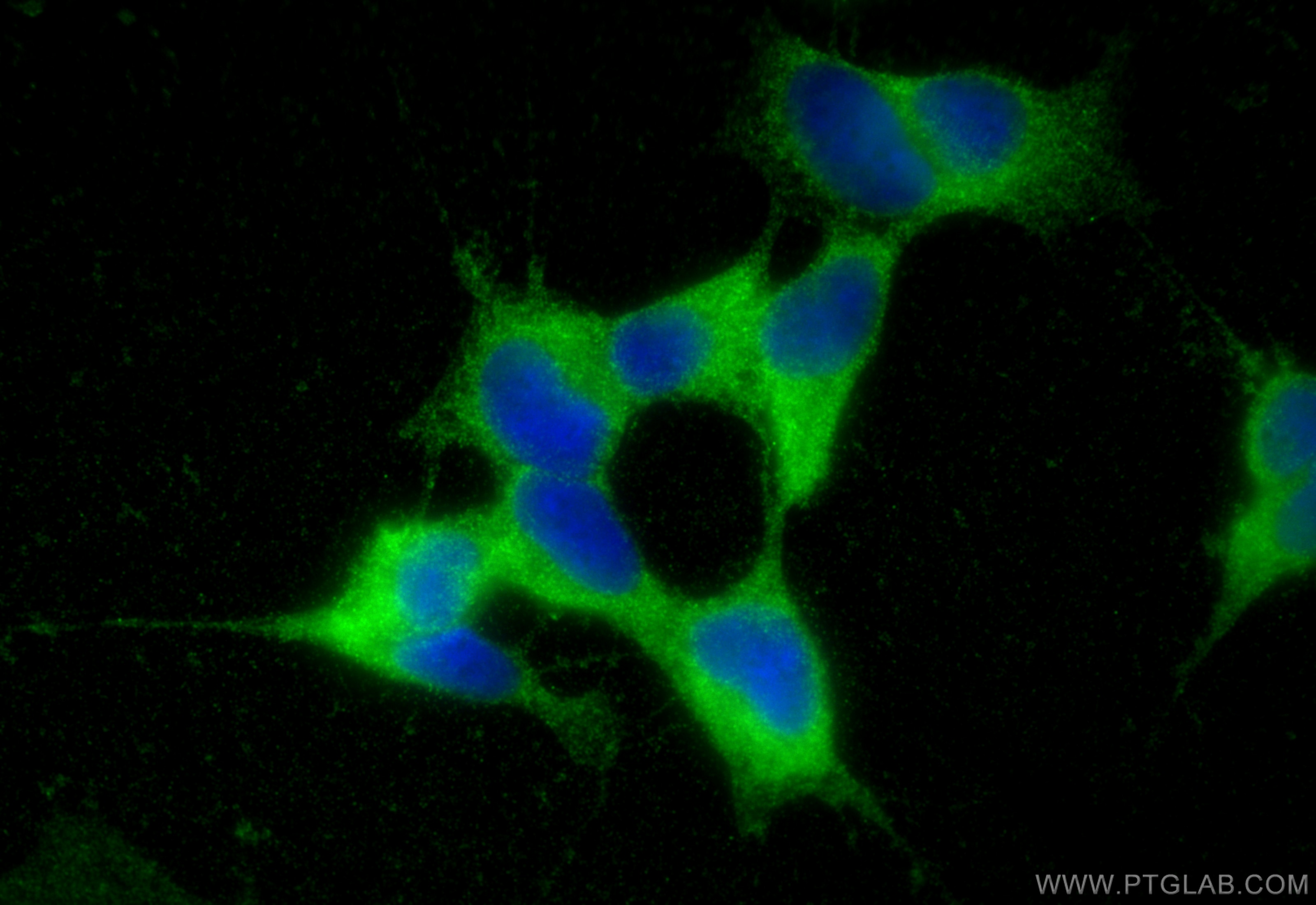 Immunofluorescence (IF) / fluorescent staining of SH-SY5Y cells using CRMP5 Polyclonal antibody (10525-1-AP)