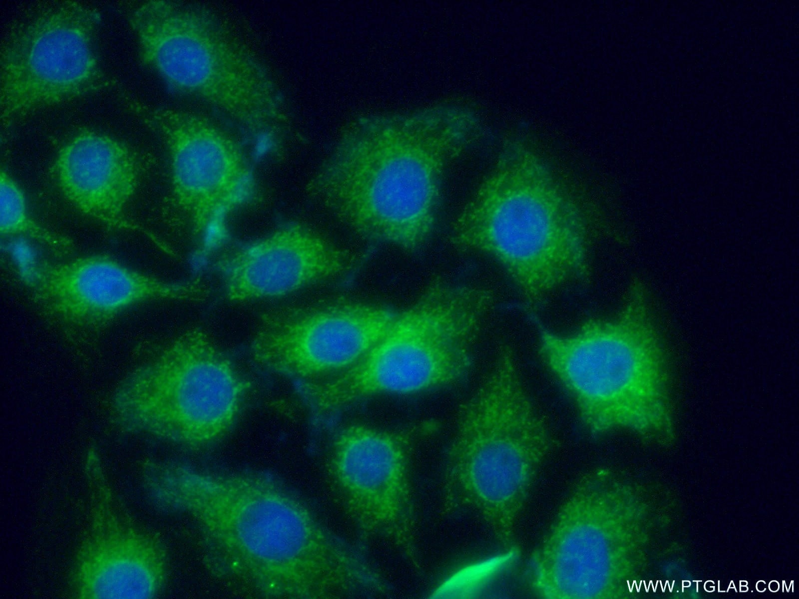 Immunofluorescence (IF) / fluorescent staining of SH-SY5Y cells using CRMP5 Polyclonal antibody (10525-1-AP)