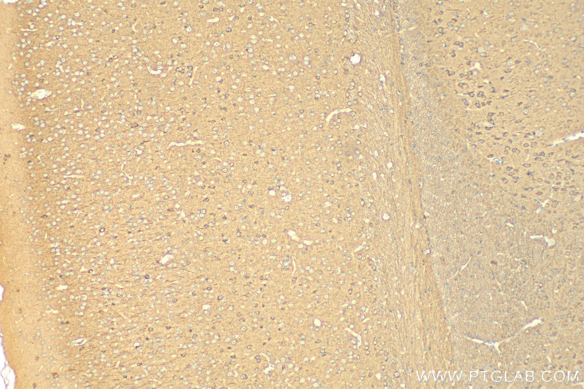 Immunohistochemistry (IHC) staining of mouse brain tissue using CRMP5 Polyclonal antibody (10525-1-AP)