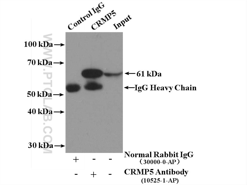 Immunoprecipitation (IP) experiment of mouse brain tissue using CRMP5 Polyclonal antibody (10525-1-AP)