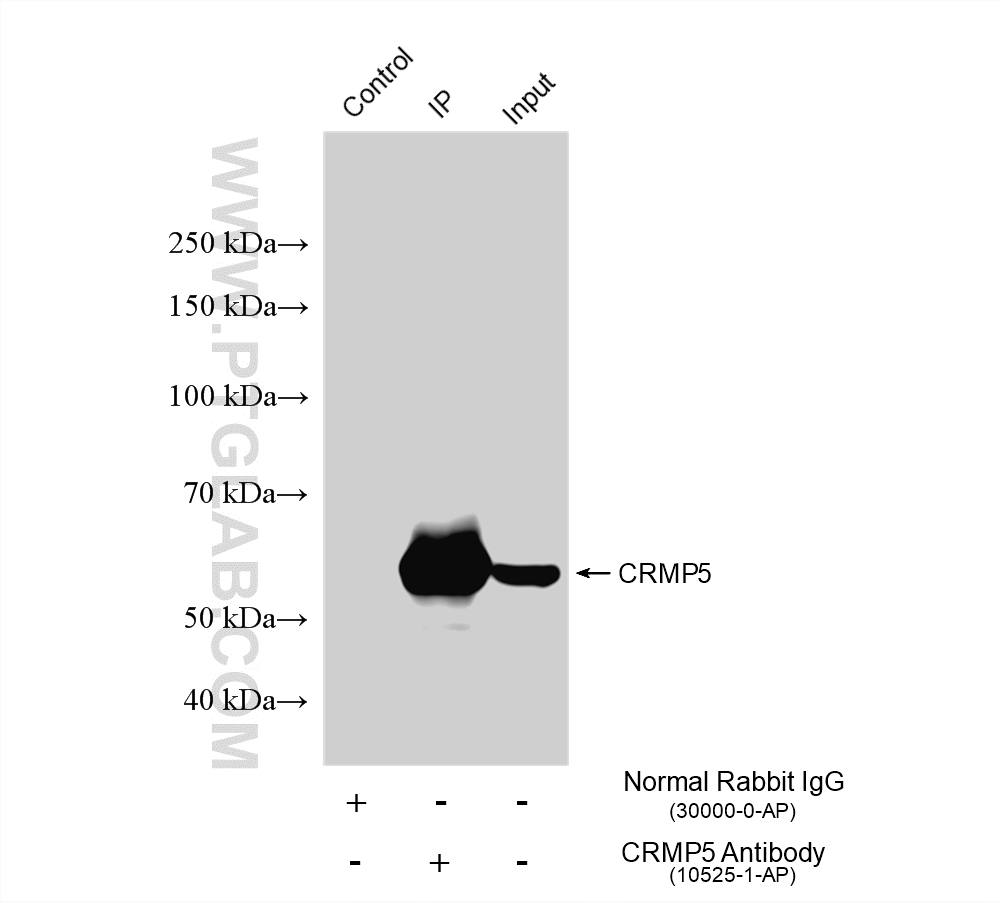 IP experiment of mouse brain using 10525-1-AP Immunoprecipitation (IP) experiment of mouse brain tissue using CRMP5 Polyclonal antibody (10525-1-AP)