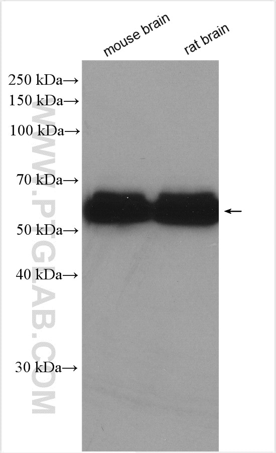 Western Blot (WB) analysis of various lysates using CRMP5 Polyclonal antibody (10525-1-AP)