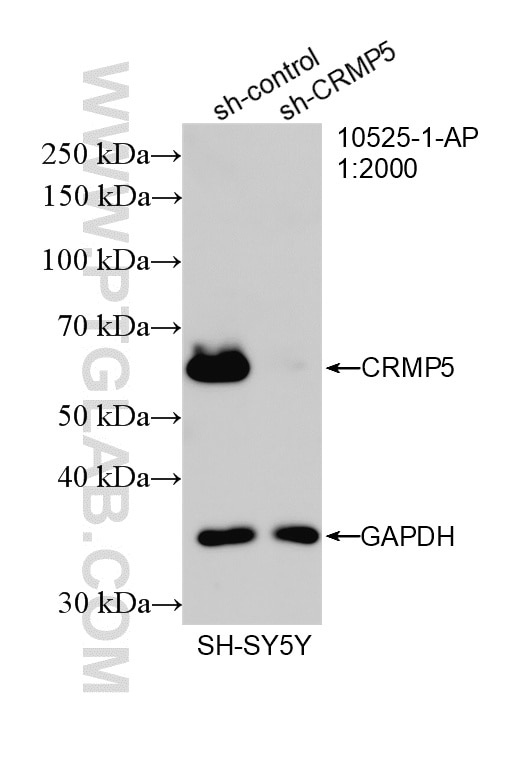 Western Blot (WB) analysis of SH-SY5Y cells using CRMP5 Polyclonal antibody (10525-1-AP)