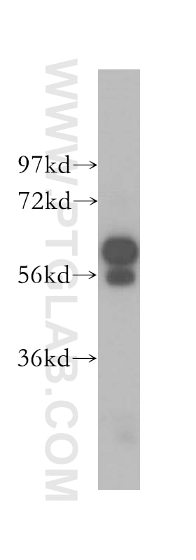 Western Blot (WB) analysis of mouse brain tissue using CRMP5 Polyclonal antibody (10525-1-AP)