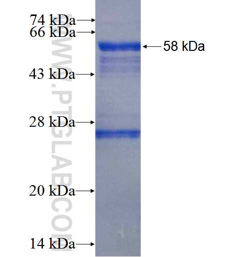 DPYSL5 fusion protein Ag0783 SDS-PAGE
