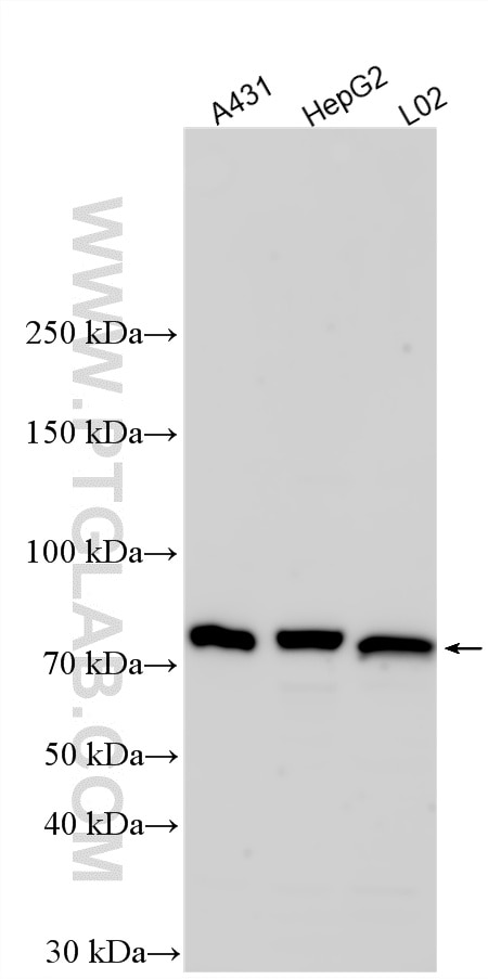 A431 cells were subjected to SDS PAGE followed by western blot with 33911-1-AP (DQX1 antibody) at dilution of 1:1000 incubated at room temperature for 1.5 hours. Western Blot (WB) analysis of A431 cells using DQX1 Polyclonal antibody (33911-1-AP)
