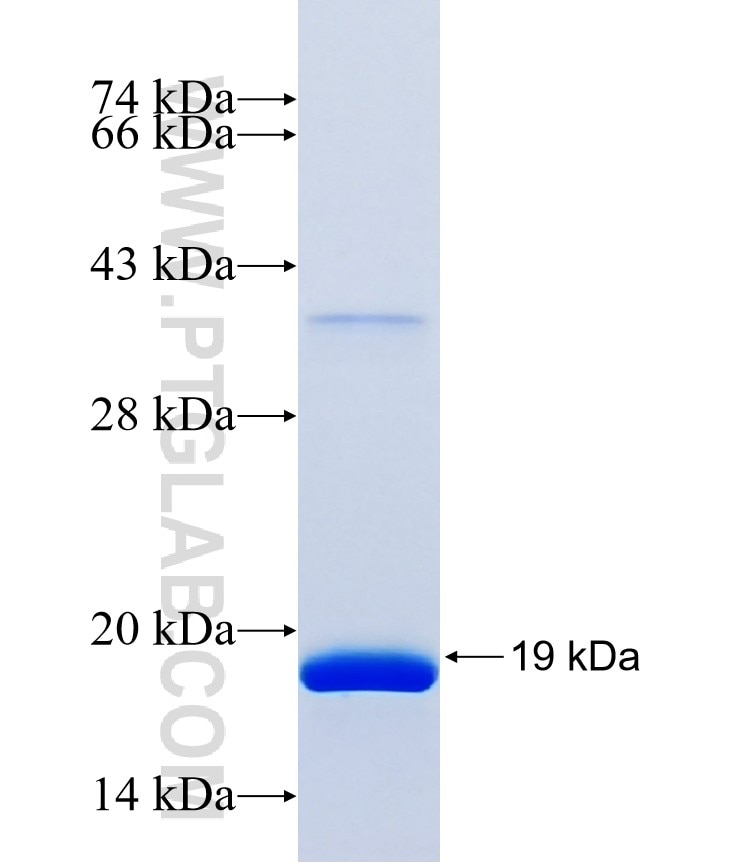 DQX1 fusion protein Ag40814 SDS-PAGE DQX1 fusion protein Ag40814 SDS-PAGE