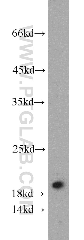 Western Blot (WB) analysis of PC-3 cells using DR1 Polyclonal antibody (10406-1-AP)