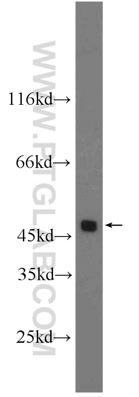 Western Blot (WB) analysis of Jurkat cells using DR4 Polyclonal antibody (24063-1-AP)