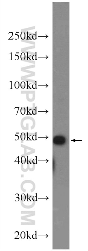 Western Blot (WB) analysis of Jurkat cells using DR4 Polyclonal antibody (24063-1-AP)