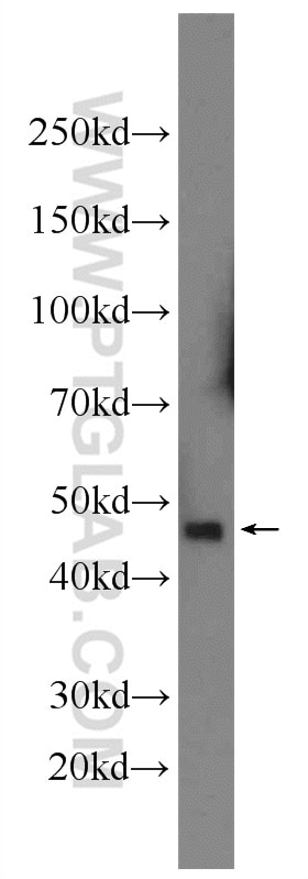 Western Blot (WB) analysis of HeLa cells using DR4 Polyclonal antibody (24063-1-AP)