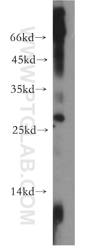Western Blot (WB) analysis of human heart tissue using DRAP1 Polyclonal antibody (11020-1-AP)