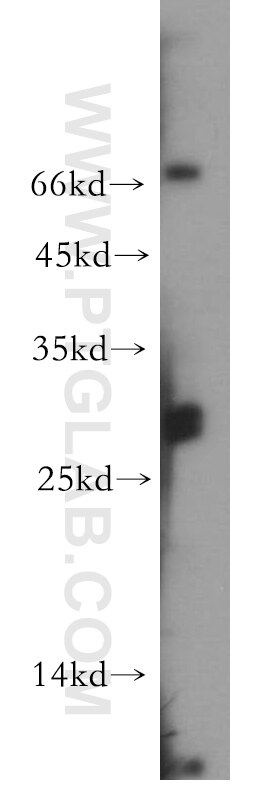 Western Blot (WB) analysis of human brain tissue using DRAP1 Polyclonal antibody (11020-1-AP)