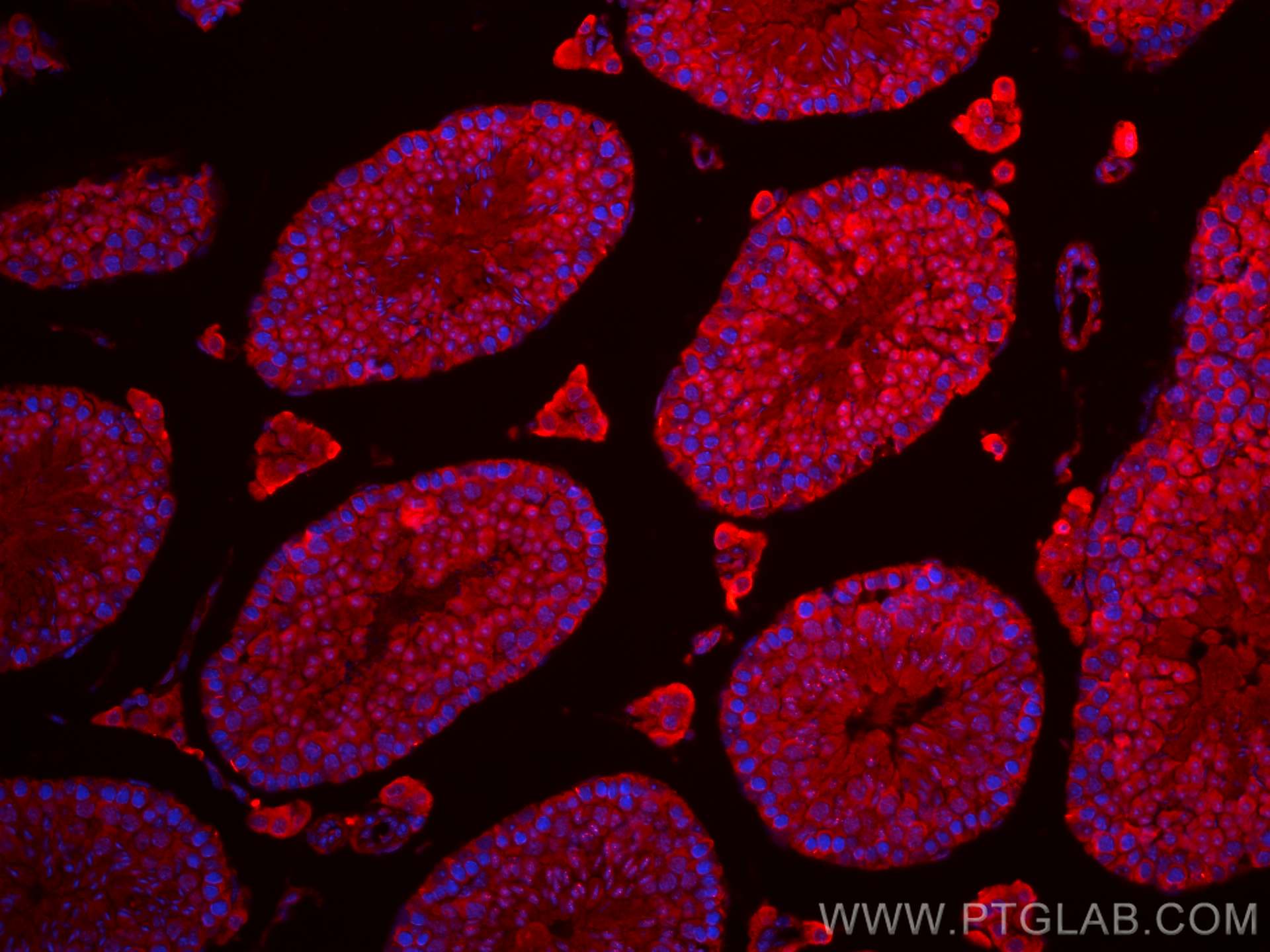 Immunofluorescence (IF) / fluorescent staining of mouse testis tissue using DRC1 Polyclonal antibody (26219-1-AP)